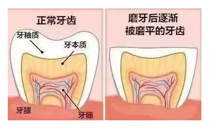 大连齿医生口腔科普没有蛀牙还牙疼？这4个隐患不能忽视