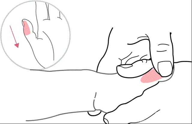 低热没精神伴有盗汗,盗汗严重伴有低热