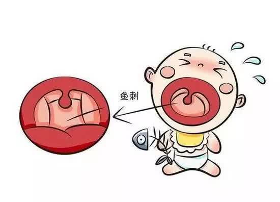 宝宝卡鱼刺了去医院怎么解决,宝宝鱼刺卡喉咙急救方法