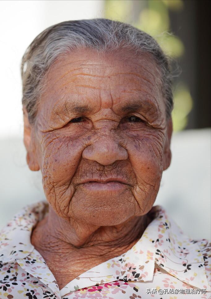 人身上的老年斑怎么去除,年轻人长老年斑消除最好的方法