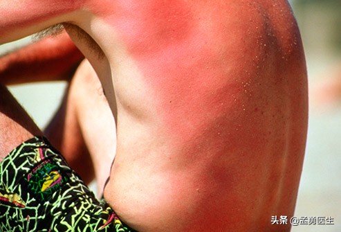 天气热医生科普视频,天气太热了医生提醒