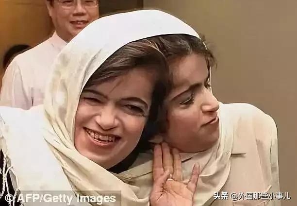 罕见双头连体人能活多久,诡异的双头生物