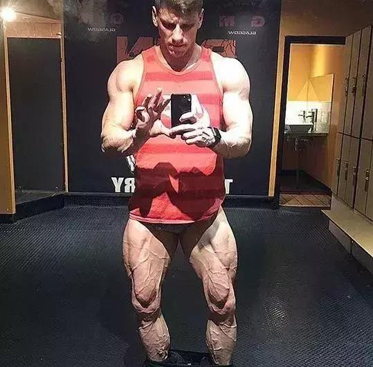 26岁健美冠军小腿静脉爆裂,22岁小伙健身过猛导致内脏撕裂