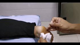 跟骨骨刺为什么脚后跟遇凉就疼,脚后跟跟骨骨刺怎么办