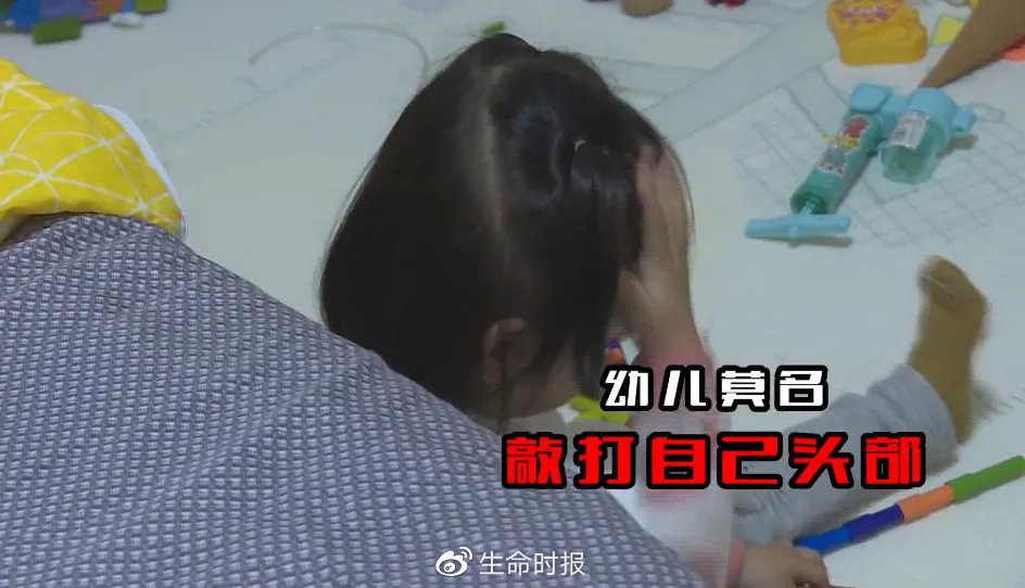 假奶粉喝出的大头娃,假奶粉喝了的症状图片