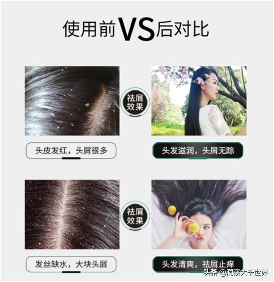 舒霖去屑止痒洗发水真假测评,去屑国货神器