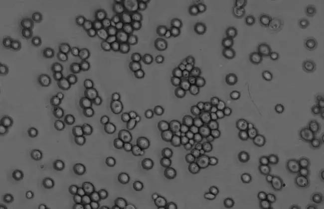 让男人悲伤女人沉默的霉菌，到底是个什么东东？