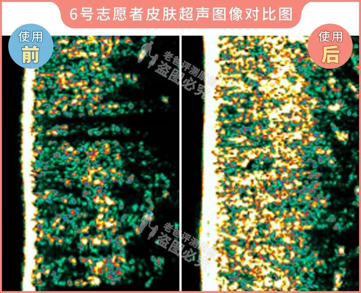 300块的网红美容仪有效果吗,网红家用美容仪测评