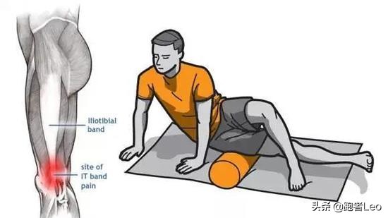解决髂胫束综合征一劳永逸的办法,怎样快速缓解髂胫束综合征