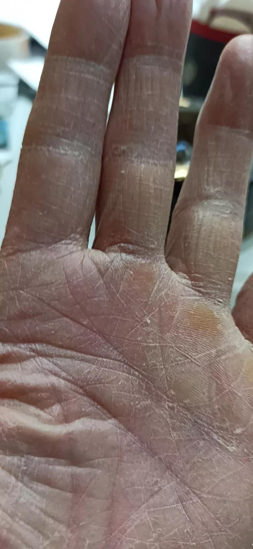 一个0感染0疑似0发热的小区，背后有位“陈经理”