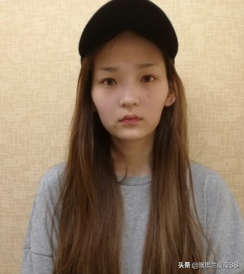 怎么减掉脸部的赘肉,怎么减掉脸颊上的肥肉