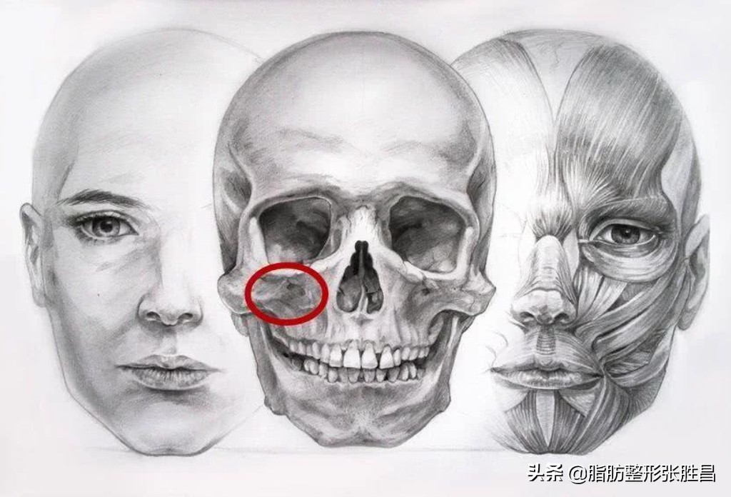 颧骨突出脸型长不好看,脸比较凶如何修饰