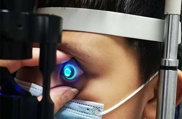 戴角膜塑形镜十年的感受,昂贵的角膜塑形镜