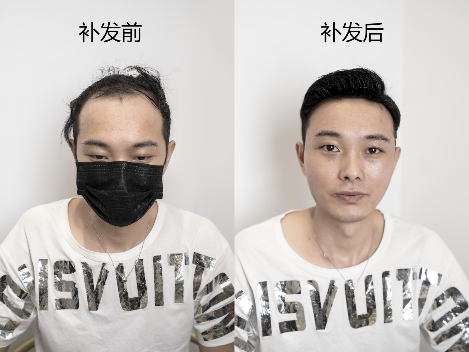 亲，建议你这边把“定制假发”戴上，不然脱单有点难