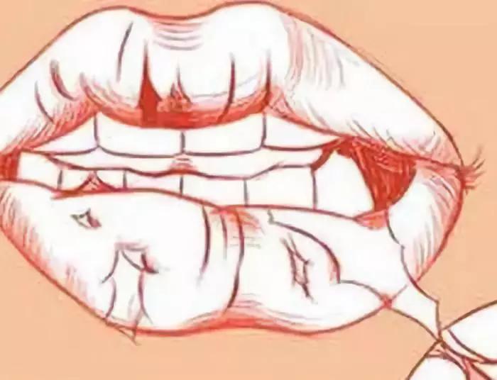 多喝水嘴唇还是干裂起皮怎么办,嘴唇干燥起皮反反复复