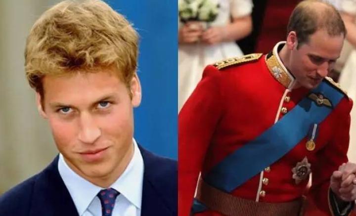 贝克汉姆秃了,贝克汉姆的头发秃了上热搜