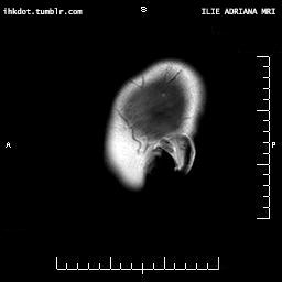 小痘痘的治疗方法,长痘不要惊慌教你自救小妙招