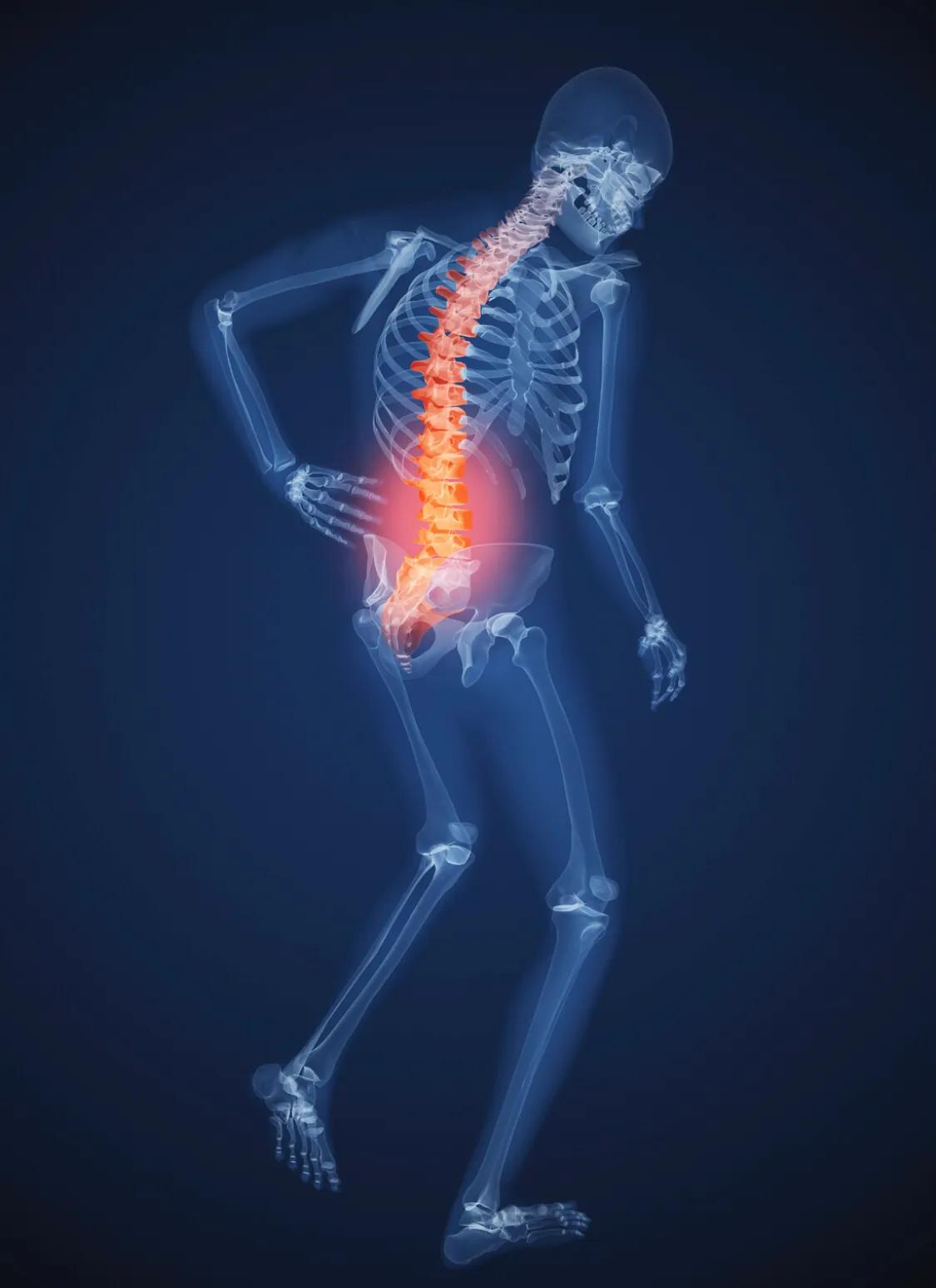 腰痛诊疗与康复书籍,腰痛病例日常诊疗记录