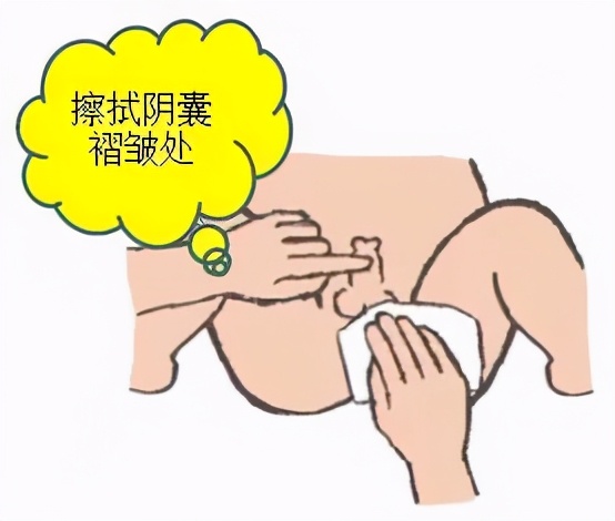 宝宝护理不当的后果,婴儿私部护理三大禁忌