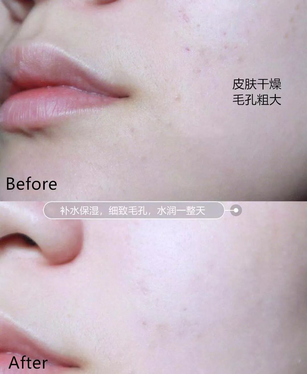 长黑头VS不长黑头差距这么大?精致女孩如何绕过黑头这道坎?