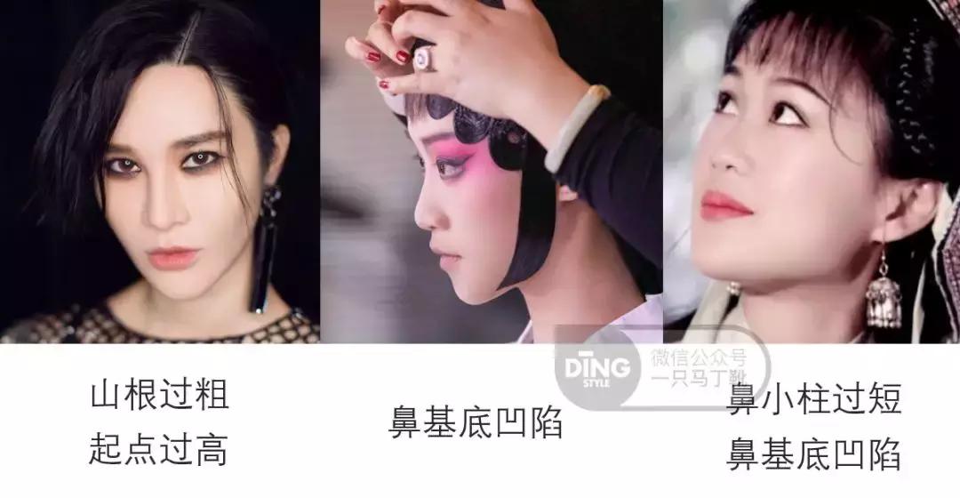 凹面型侧脸怎么改善,凹面型侧脸是怎么造成的