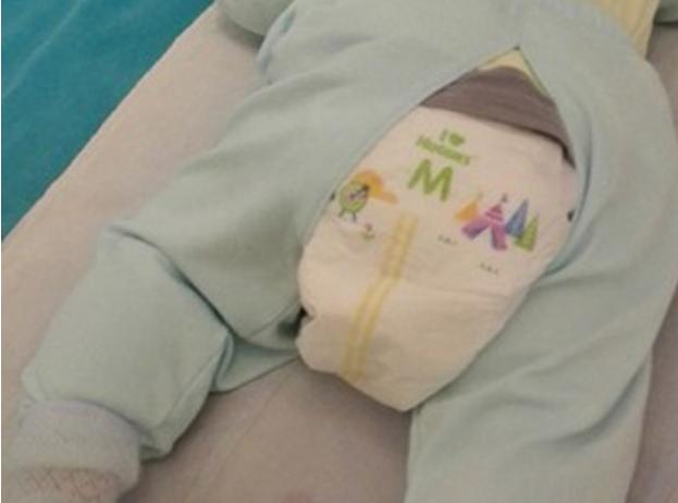 给小孩穿纸尿裤,为什么不建议给小孩穿纸尿裤