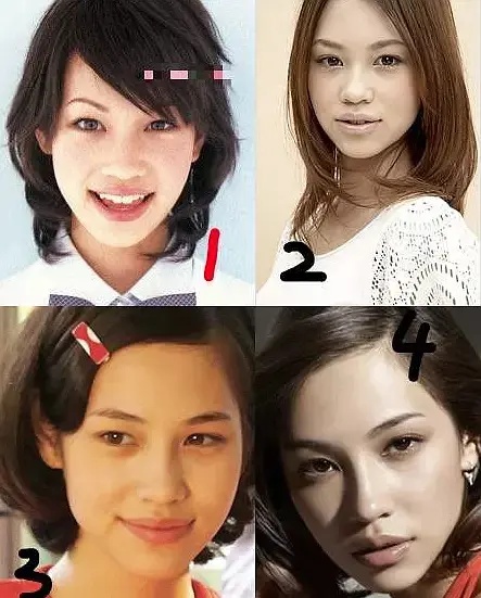 日本整容惊人案例,日本整容是不是最先进