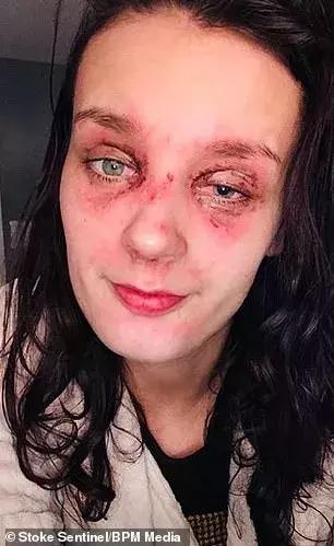 因为一时疏忽让自己悔恨终生,因为一时的疏忽造成了终身后悔