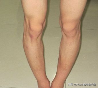 真翘臀和假翘臀怎么辨别,怎样判断翘臀是不是假的