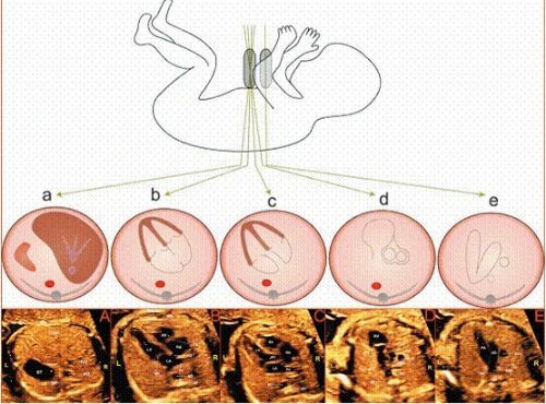 怀孕宝宝心跳188次一分钟怎么办,怀孕宝宝突然心跳停了怎么回事