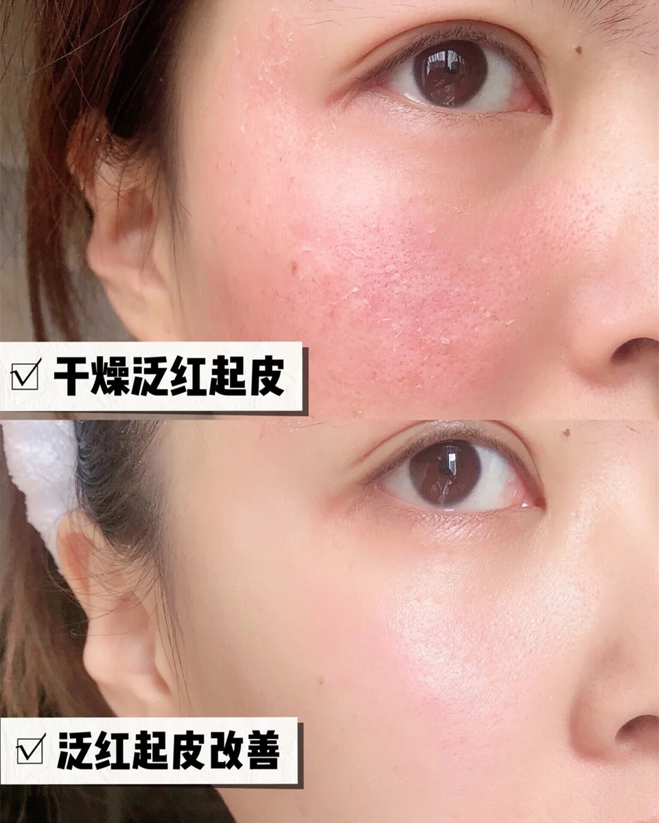 李佳琦推荐十款最好用面霜,李佳琦推荐5款平价面霜