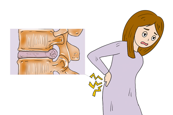 产后腰疼打麻药有什么危害,产后腰痛是打麻药的原因吗