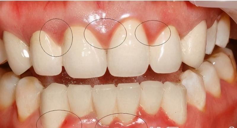 上海牙齿松动怎么修复,牙齿松动不适怎么解决