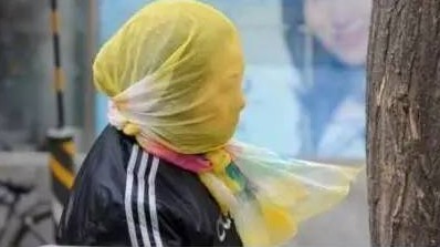 柳絮纷飞季怎么预防,柳絮纷飞这天气应该注意些啥