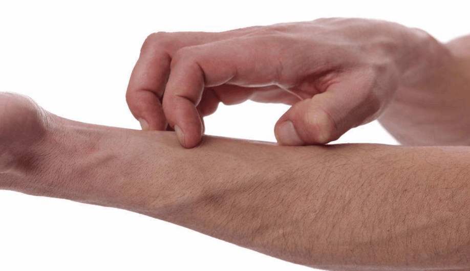 不同部位长痘痘的原因和应对方法,为什么老是长痘痘怎样才能不长痘