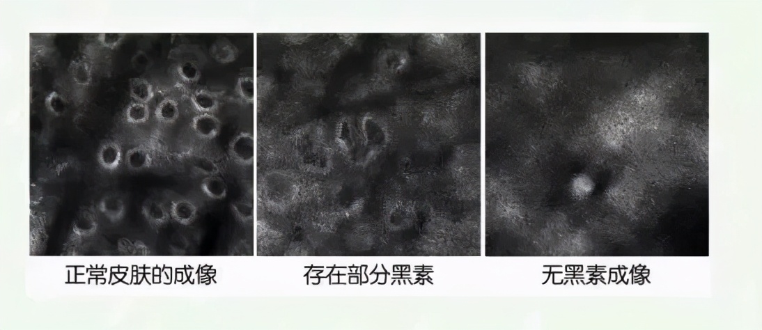 为什么年纪轻轻就头发花白,为什么年纪轻轻就长白头发