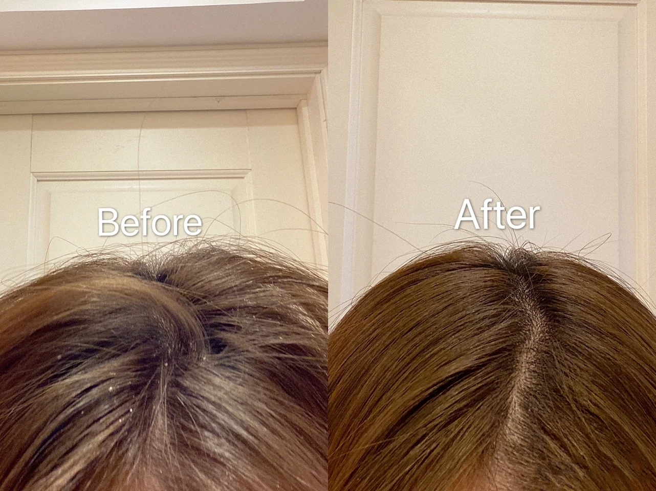 身上的螨虫会粘在衣服上吗,身上螨虫太多身体会烂么