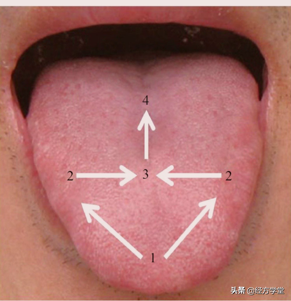 观舌养生舌诊入门一学就会,舌诊图片与经方治疗