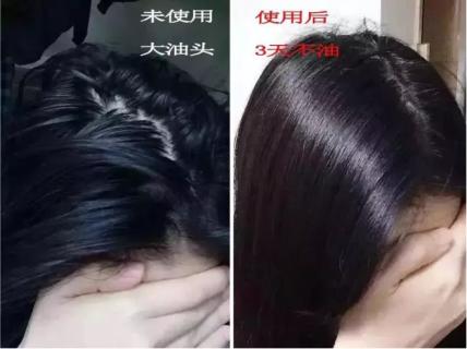 油头救星澳洲茶树洗发水,茶树精油酸性顺滑洗发水