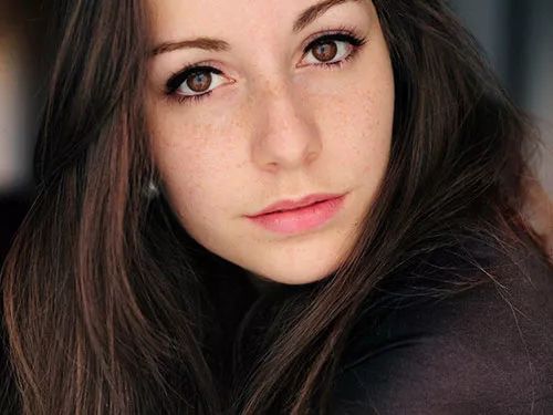 脸上的黑色素去哪里治,脸上黑色素怎么消除小妙招