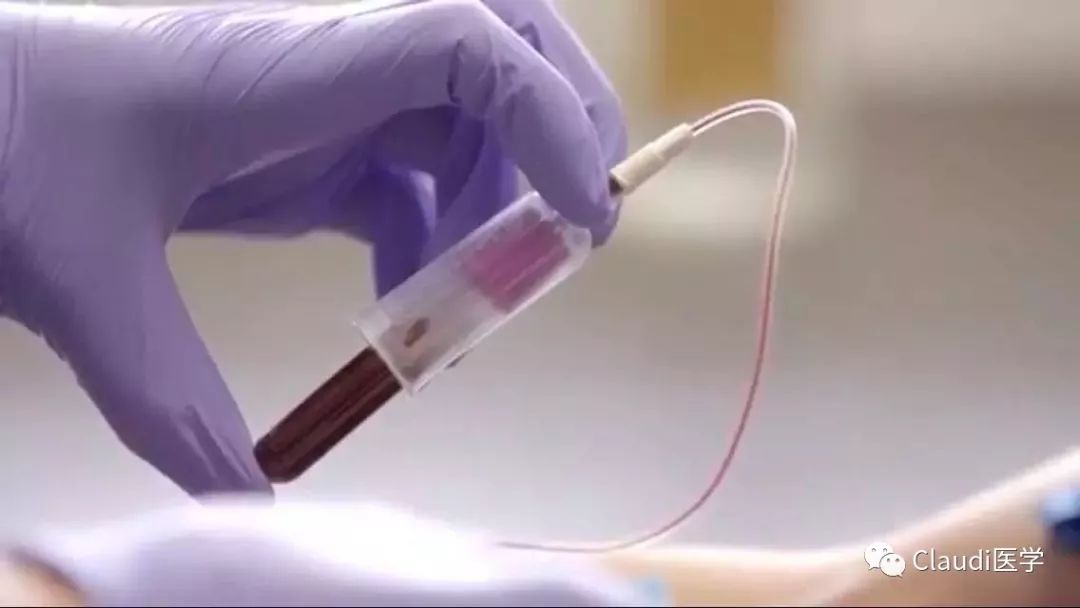 乔布斯为什么选择偏方治癌,乔布斯听医生的建议能治好癌症吗