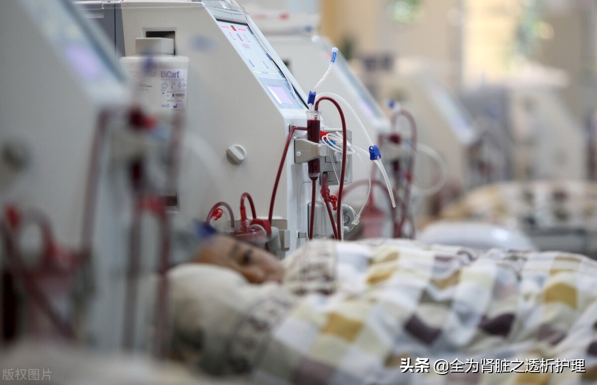 血液透析护理个案,血液透析置管患者居家护理