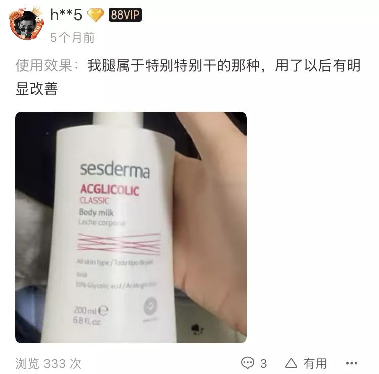 吴昕的腿到底怎么瘦的,吴昕原来腿型能通过健身瘦下来吗