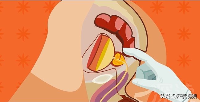 前列腺炎尿频治不好,前列腺炎好治不好治