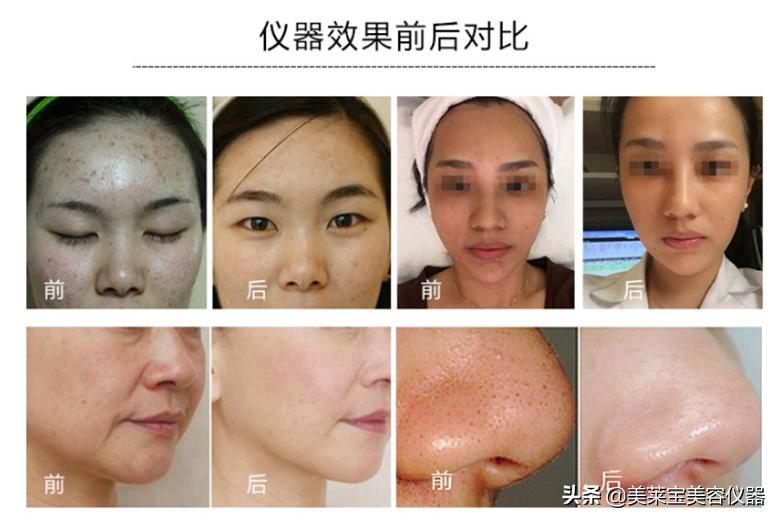 护肤品抹脸上是吸收了还是干了,护肤品擦脸上瞬间就吸收了