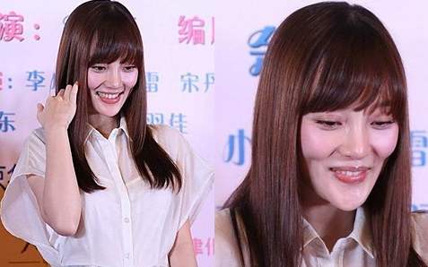 女人整容成瘾差点毁容才收手,女网红整容上瘾花费百万整容失败