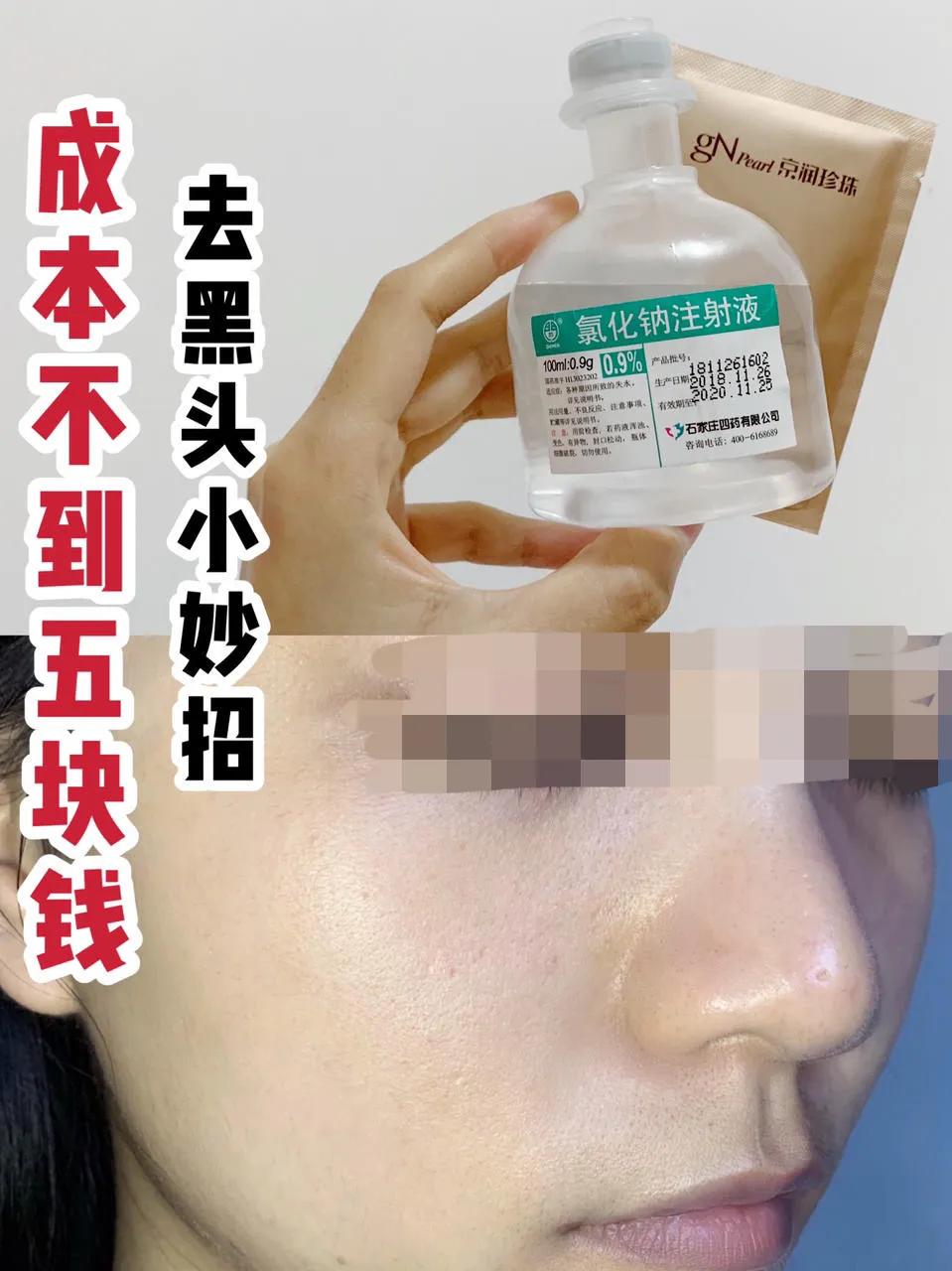 好用的去除黑头小妙招,去除黑头小窍门一招解决