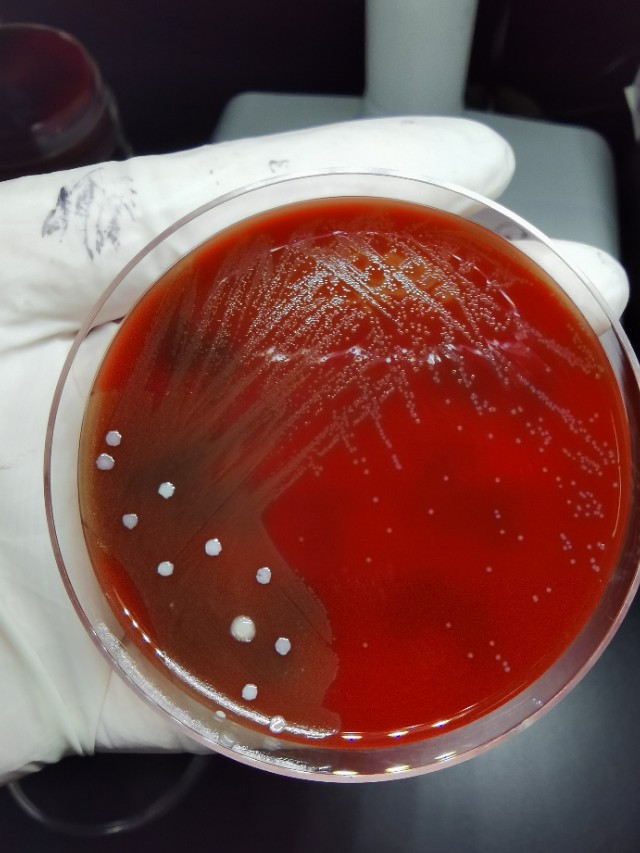 女人有妇科困扰吗,女人常见的妇科问题