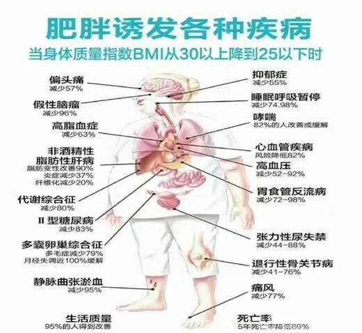 肥胖引起的糖尿病减肥后能治愈吗,肥胖减重手术知识问答