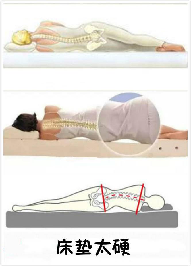 睡硬板床不要睡软床,医生让睡硬床垫真的对吗